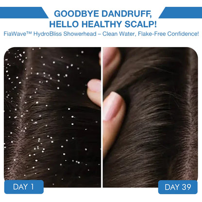 before and after dandruff reduction results. Left: scalp with visible dandruff on Day 1. Right: noticeably cleaner, healthier, and flake-free scalp after 39 days of using filtered water. Promotes scalp hydration and reduces dryness.
